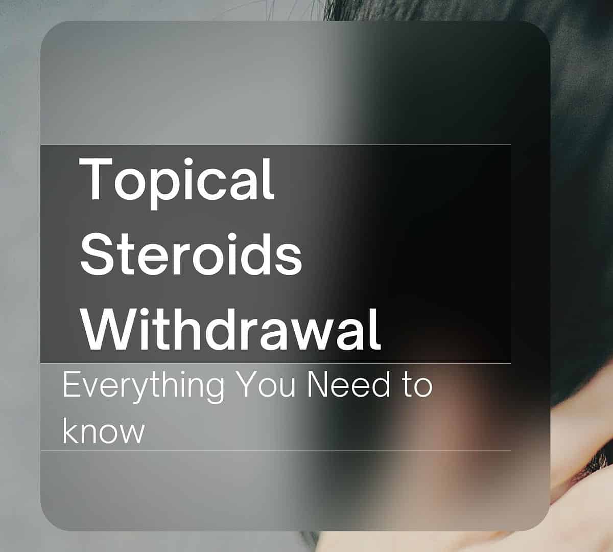 What You Need To Know About Topical Steroids Withdrawal